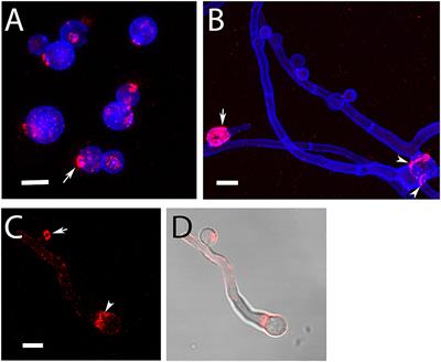 Characterization of Aspergillus terreus Accessory Conidia and Their Interactions With Murine Macrophages